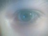 myeye.jpg