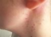 dots on neck.jpg